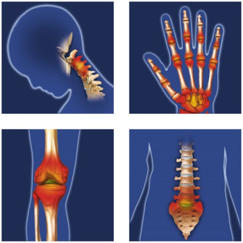 Balzams Hondroredaktor