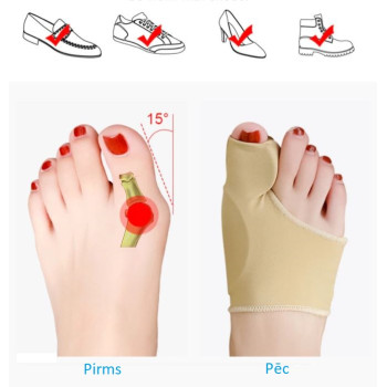 Lielā pirksta fiksators (Hallus Valgus)