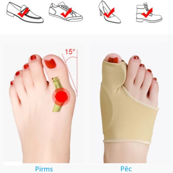 Lielā pirksta fiksators (Hallus Valgus)